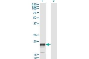 Western Blot analysis of PSCA expression in transfected 293T cell line by PSCA monoclonal antibody (M02), clone 1E1. (PSCA Antikörper  (AA 23-95))