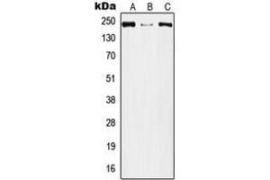 Western blot analysis of Plexin A2 expression in A549 (A), Raw264. (Plexin A2 Antikörper  (Center))