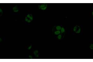 Immunofluorescence staining of MCF7 Cells with ABIN7127801 at 1:50, counter-stained with DAPI. (Rekombinanter STAG2 Antikörper)