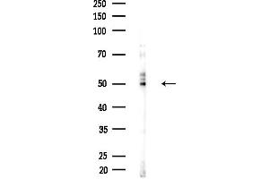 Western blot analysis of lysates from  cells(heat-shock,45 min treatment), using KCNJ4 Antibody at 1/1000 dilution.