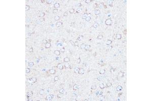 Immunohistochemistry of paraffin-embedded mouse brain using TSC2 Rabbit pAb (ABIN1683176, ABIN5663676 and ABIN7101314) at dilution of 1:100 (40x lens). (Tuberin Antikörper)