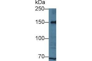 Detection of LRP8 in Human Hela cell lysate using Polyclonal Antibody to Low Density Lipoprotein Receptor Related Protein 8 (LRP8) (LRP8 Antikörper  (AA 696-941))