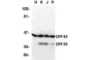 Western blot analysis of DFF45 in HeLa (H), K562 (K) Jurkat (J), and Raji (R) cell lysates with DFF45 antibody at 2μg/ml. (DFFA Antikörper  (AA 2-21))