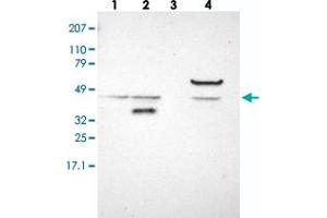 Western blot analysis of Lane 1: RT-4, Lane 2: EFO-21, Lane 3: U-138 MG, Lane 4: Liver, Lane 5: Tonsil with ACOT4 polyclonal antibody . (ACOT4 Antikörper)