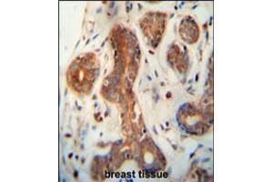 CEPT1 antibody immunohistochemistry analysis in formalin fixed and paraffin embedded human breast tissue followed by peroxidase conjugation of the secondary antibody and DAB staining.