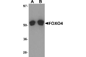 Western Blotting (WB) image for anti-Forkhead Box O4 (FOXO4) (N-Term) antibody (ABIN1031692) (FOXO4 Antikörper  (N-Term))