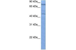 ZNF555 antibody used at 0. (ZNF555 Antikörper  (C-Term))