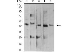 Western blot analysis using ARFGAP1 mouse mAb against MOLT4 (1), C2C12 (2), HepG2 (3), MCF-7 (4), and Lncap (5) cell lysate.
