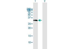 Western Blot analysis of C16orf57 expression in transfected 293T cell line by C16orf57 MaxPab polyclonal antibody. (C16orf57 Antikörper  (AA 1-265))