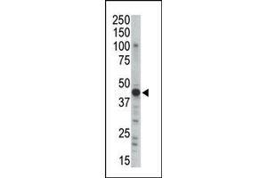 Image no. 1 for anti-Protein Kinase, CAMP-Dependent, Regulatory, Type II, beta (PRKAR2B) (N-Term) antibody (ABIN359121)