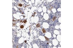 Immunohistochemical staining (Formalin-fixed paraffin-embedded sections) of human bone marrow with SGK493 polyclonal antibody  shows strong cytoplasmic positivity in megakaryocytes.