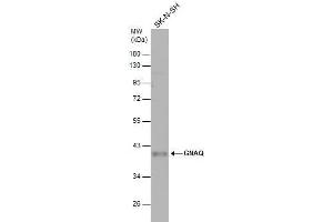 WB Image Whole cell extract (30 μg) was separated by 10% SDS-PAGE, and the membrane was blotted with GNAQ antibody , diluted at 1:500.
