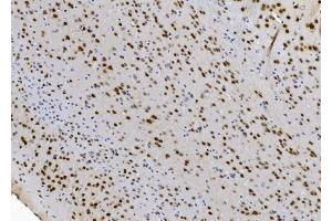 IHC analysis of NOVA2 using anti-NOVA2 antibody (ABIN7599078).