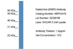WB Suggested Anti-ZPBP2  Antibody Titration: 0. (ZPBP2 Antikörper  (N-Term))