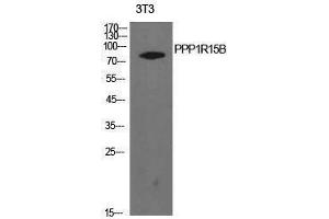 Western Blotting (WB) image for anti-Protein Phosphatase 1, Regulatory Subunit 15B (PPP1R15B) (Internal Region) antibody (ABIN3181424) (PPP1R15B Antikörper  (Internal Region))