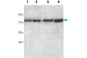 Western blot analysis of HepG2 (Lane 1), HeLa (Lane 2), MCF-7 (Lane 3) and SW480 (Lane 4) cell lysate with AGPS polyclonal antibody  at 1 : 500 dilution. (AGPS Antikörper  (AA 462-632))