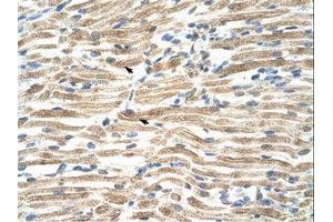 Image no. 1 for anti-YY1 Associated Factor 2 (YAF2) (AA 46-95) antibody (ABIN203352) (YAF2 Antikörper  (AA 46-95))