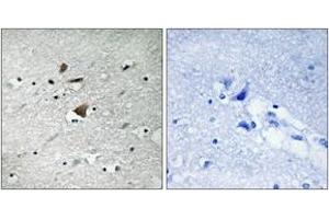 Immunohistochemistry (IHC) image for anti-Anaphase Promoting Complex Subunit 1 (ANAPC1) (AA 321-370) antibody (ABIN2889133) (APC1 Antikörper  (AA 321-370))