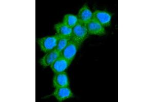 anti-Alanine--tRNA Ligase, Mitochondrial (AARS-1) (AA 729-968) antibody