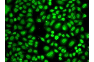 Immunofluorescence analysis of A549 cells using CREB1 antibody (ABIN4903374) at dilution of 1:100 (40x lens). (CREB1 Antikörper)