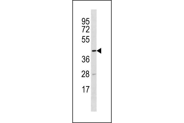 TTC5 Antikörper  (C-Term)