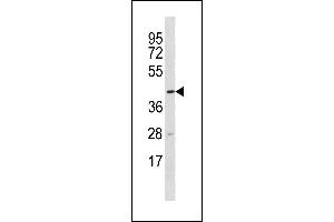 TTC5 Antikörper  (C-Term)
