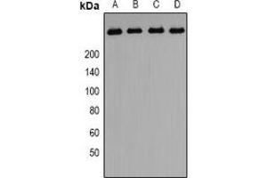 Western blot analysis of PIP5K expression in A549 (A), HepG2 (B), PC3 (C)rat testis (D) whole cell lysates. (PIKFYVE Antikörper  (N-Term))
