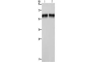 Western Blotting (WB) image for anti-Elastin (ELN) antibody (ABIN2428081) (Elastin Antikörper)