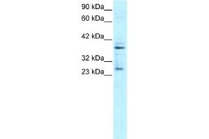 WB Suggested Anti-SIRT5 Antibody Titration:  0. (SIRT5 Antikörper  (C-Term))