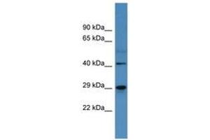 Image no. 1 for anti-Carbonic Anhydrase II (CA2) (AA 130-179) antibody (ABIN6746751) (CA2 Antikörper  (AA 130-179))