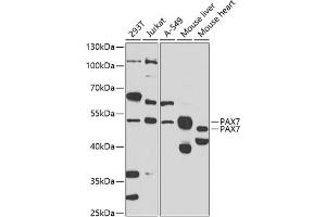 Western blot analysis of extracts of various cell lines, using P antibody (ABIN6132464, ABIN6145263, ABIN6145265 and ABIN6223179) at 1:1000 dilution. (PAX7 Antikörper  (AA 289-518))