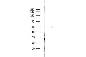 anti-MLF1 Interacting Protein (MLF1IP) (N-Term) antibody