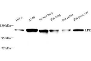 Western blot analysis of LRP (ABIN7074548) at dilution of 1: 500 (MVP Antikörper)