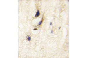 Formalin-fixed and paraffin-embedded human brain tissue reacted with DM1 Antibody (C-term) (ABIN389180 and ABIN2839343) , which was peroxidase-conjugated to the secondary antibody, followed by DAB staining.