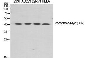 Western Blotting (WB) image for anti-Myc Proto-Oncogene protein (MYC) (pSer62) antibody (ABIN5959056) (c-MYC Antikörper  (pSer62))