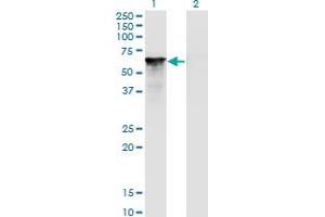 Splicing Factor 1 Antikörper  (AA 1-110)