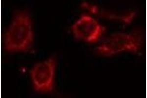 ABIN6275406 staining HT29 cells by IF/ICC. (NDRG4 Antikörper  (Internal Region))