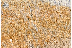 ABIN6262815 and ABIN6272922 at 1/100 staining Rat kidney tissue by IHC-P. (FERMT2 Antikörper  (C-Term))