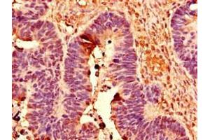 Immunohistochemistry (IHC) image for anti-Polymerase (RNA) II (DNA Directed) Polypeptide C, 33kDa (POLR2C) (AA 2-275) antibody (ABIN7150430)