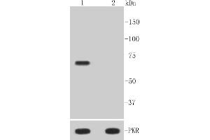 Lane 1: Hela treated with Calyculin A and TNF-alpha whole cell lysates, Lane 2: Untreated Hela whole cell lysates, probed with PKR(T446) (10A1) Monoclonal Antibody  at 1:1000 overnight at 4˚C. (EIF2AK2 Antikörper  (pThr446))