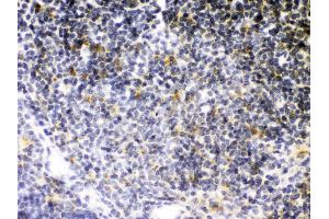 Anti- TNF Receptor II Picoband antibody, IHC(P) IHC(P): Mouse Thymus Tissue