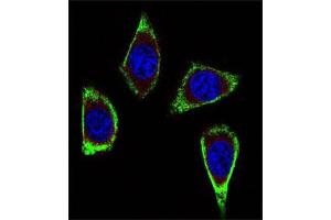 Immunofluorescent staining of MDA-MB231 cell reacted with RET monoclonal antibody  at 1:10-1:50 dilution.