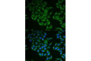 Immunofluorescence analysis of A549 cell using CD247 antibody. (CD247 Antikörper)