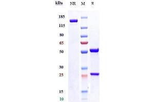 Anti-SLITRK6 Reference Antibody (sirtratumab) on SDS-PAGE under reducing (R) condition.