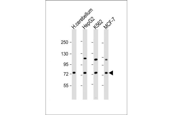 SMPD1 Antikörper  (C-Term)