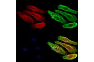 ABIN6262635 and ABIN6273051 staining Hela cells by IF/ICC. (Importin 4 Antikörper  (Internal Region))