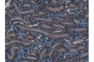 Immunohistochemistry (IHC) image for anti-Defensin beta 2 (BD-2) (AA 21-71) antibody (ABIN7430780)