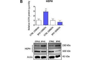 Iron export machinery-related hephaestin (HEPH) and the hemochromatosis gene (HFE) related to systemic iron loading are elevated at the mRNA level but not on the protein level in tumor-initiating cells (TICs)Expression of the HEPH gene at the mRNA level in breast non-malignant cell line MCF10A, in TICs derived from breast cancer cell lines MCF-7, BT-474, T-47D and ZR-75-30 as well as from prostate cancer cell lines DU-145 and LNCaP has been determined (A) together with protein levels in the MCF-7 cell line (CTRL) and MCF-7 derived spheres (SPH) (B). (Hephaestin Antikörper  (AA 21-120))