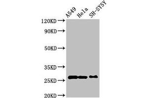 Western Blot Positive WB detected in: A549 whole cell lysate, Hela whole cell lysate, SH-SY5Y whole cell lysate All lanes: PRDX6 antibody at 4 μg/mL Secondary Goat polyclonal to rabbit IgG at 1/50000 dilution Predicted band size: 26 kDa Observed band size: 26 kDa (Peroxiredoxin 6 Antikörper  (AA 87-224))