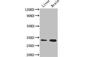 Western Blot Positive WB detected in: Mouse liver tissue, Mouse brain tissue All lanes: CD37 antibody at 2. (CD37 Antikörper  (AA 109-237))